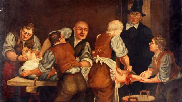 Joseph Lister e a revolução da higiene: como um cirurgião mudou a medicina e inspirou gigantes como Johnson & Johnson - Imagem do artigo original