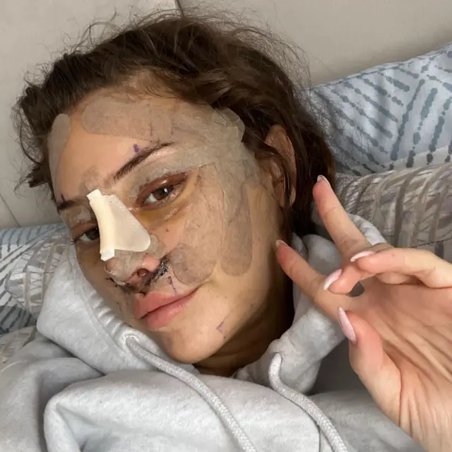 Lifting Facial: O Crescimento do Procedimento entre Jovens - Imagem do artigo original